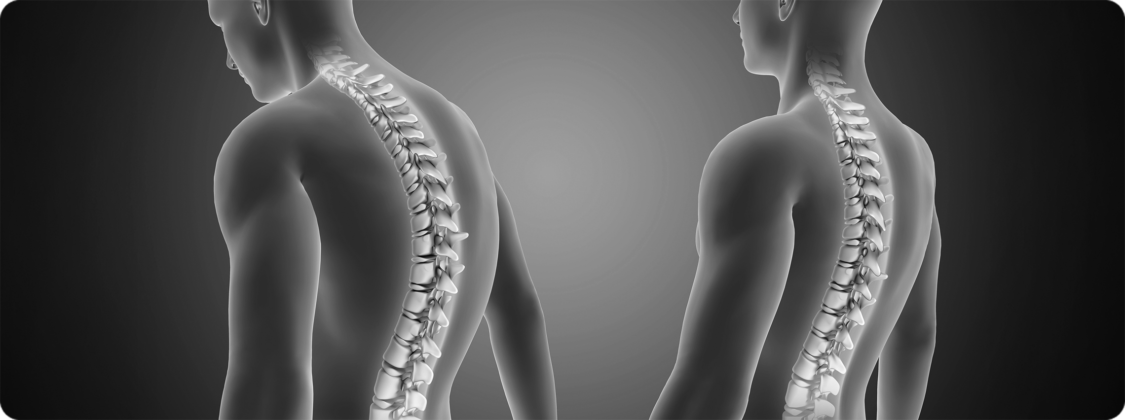 How Your Posture Messes With Your Spine (And How to Sort It Out) 